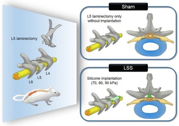 ◇연구팀은 쥐의 척추관에 생체 실리콘을 삽입한 척추관협착증 동물 모델을 제작해 실험을 진행했다.